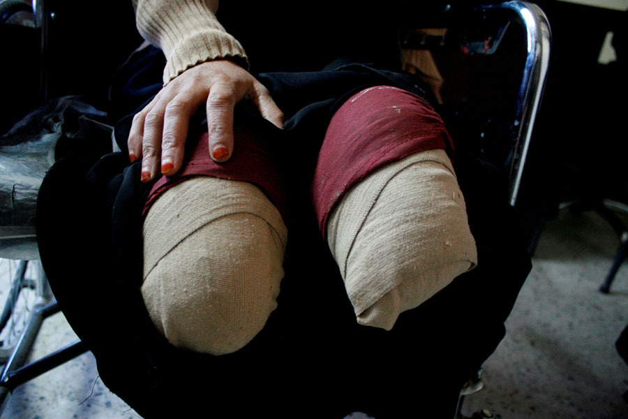 36 صورة تحكي واقع اليمن خلال العام 2017م