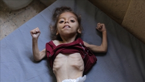 غزة تموت جوعا.. التجويع الإسرائيلي يقتل 6 فلسطينيين خلال 24 ساعة