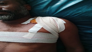 إصابة إثنين من عمال مصنع إسمنت الوحدة برصاص مسلح في أبين