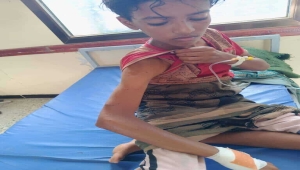 إصابة طفل برصاص قناص حوثي شمال لحج