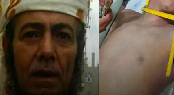 إب.. وفاة شاب خنقاً على يد قارئ رقية شرعية للعلاج من السحر