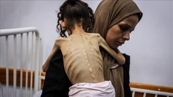 مسؤول أممي: صور الجوعى في غزة تمزق القلب ولا تحتمل