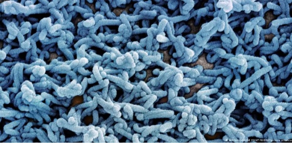 أثيوبيا تؤكد تفشي وباء 